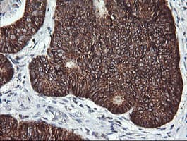 ACAA2 Antibody (clone OTI2H2)