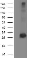 SIRT5 / Sirtuin 5 Antibody (clone OTI2A11)