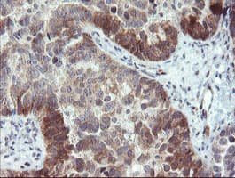 TBCC Antibody (clone OTI2B3)