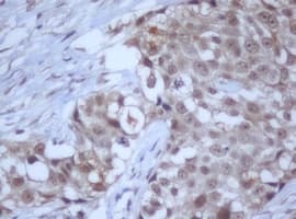 Monoclonal Mouse anti-Human DDX59 Antibody (clone OTI2G1, IHC, WB)
