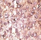 APG5 / ATG5 Antibody (aa209-238)