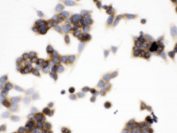CCT5 / TCP1 Epsilon Antibody