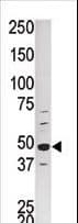 CDK16 / PCTAIRE Antibody (aa357-386)