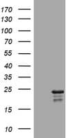 VILIP / VSNL1 Antibody (clone OTI2G1)