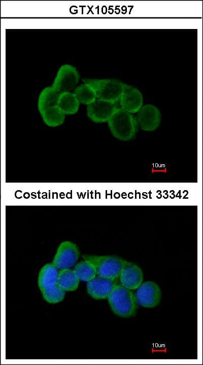 Polyclonal Rabbit anti-Human FLRT1 Antibody (aa35-255, IHC, WB)