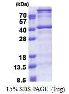 Human DNTTIP1 / TDIF1 Protein (Recombinant His)