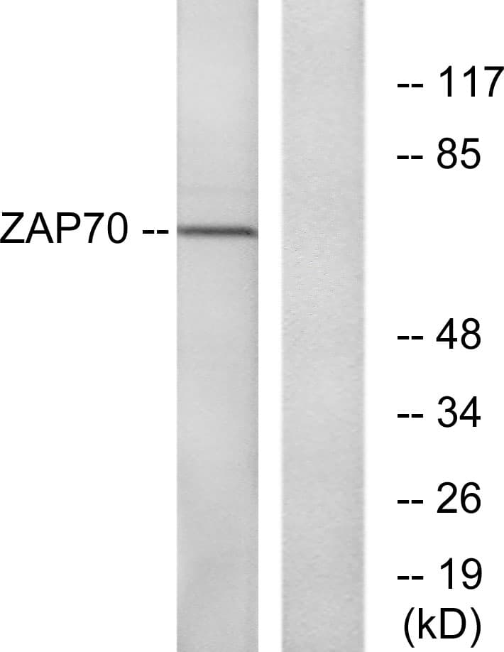ZAP70 Antibody (aa286-335)