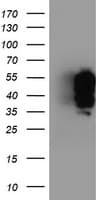 TFG Antibody (clone OTI2C3)