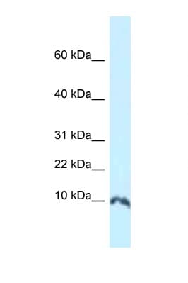 Polyclonal Rabbit anti-Mouse SUMO1 / SMT3 Antibody (N-Terminus, WB)