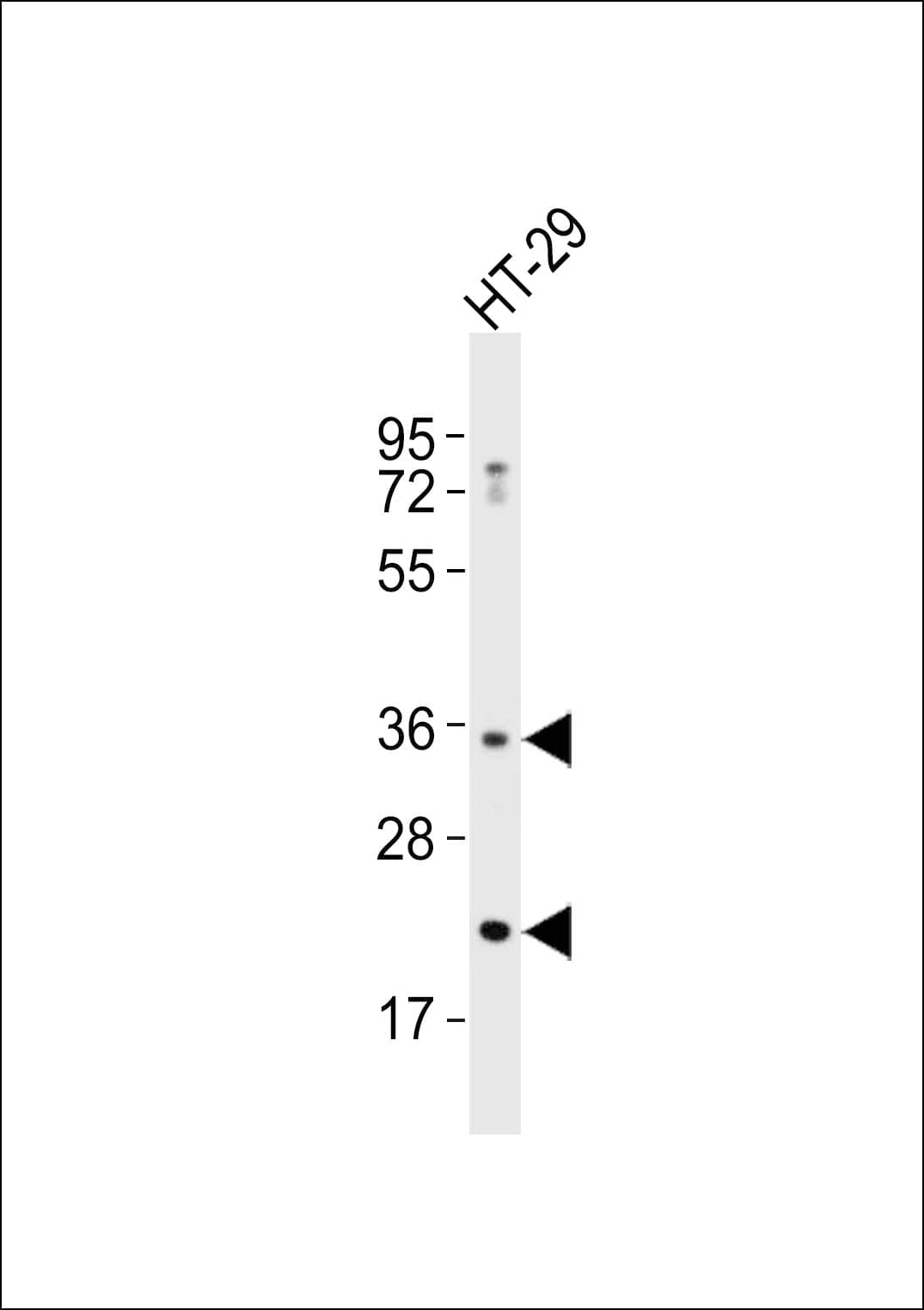 Polyclonal Rabbit anti-Human ABCC13 Antibody (WB)