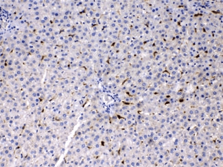 PSAT1 Antibody