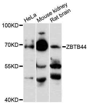 ZNF851 / ZBTB44 Antibody
