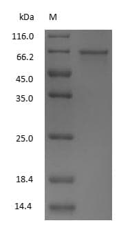 ALB / Serum Albumin Protein (Native)