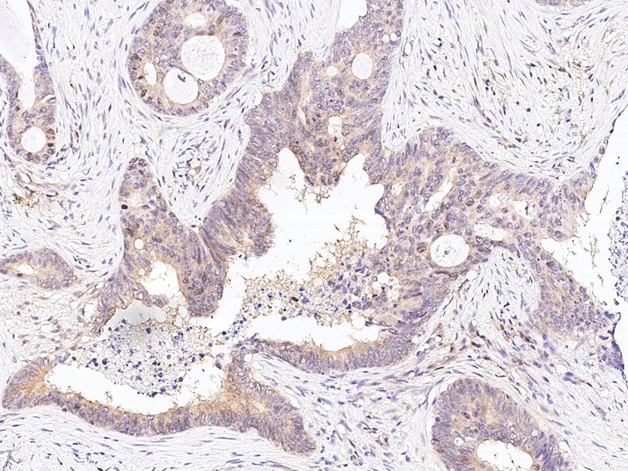 BIRC5 / Survivin Antibody (Preservative Free)