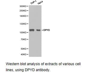 Polyclonal Rabbit anti-Human DPYD / DPD Antibody (IHC, WB)