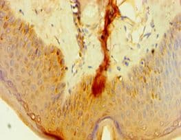 ALOXE3 Antibody (aa1-280)