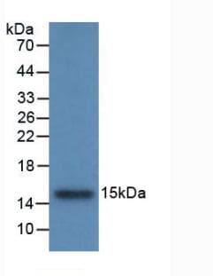 CSTB / Cystatin B / Stefin B Antibody