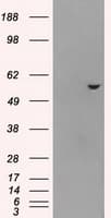 IHC-plus™ Monoclonal Mouse anti-Human ATP5B / ATP Synthase Beta Antibody (clone 6C10, IHC, WB)
