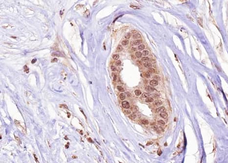 ER Alpha / Estrogen Receptor Antibody (phospho-Ser106)
