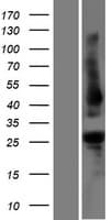 PLEKHB1 Protein (Over-Expression Lysate Myc-DDK (Flag))
