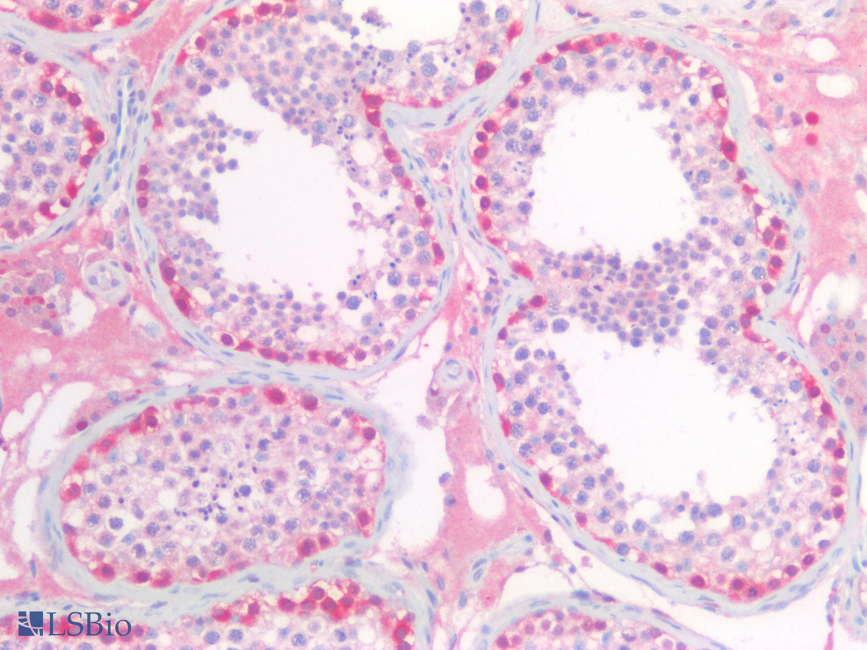 IHC-plus™ Polyclonal Goat anti-Human UCHL1 / PGP9.5 Antibody (aa58-68, IHC, WB)