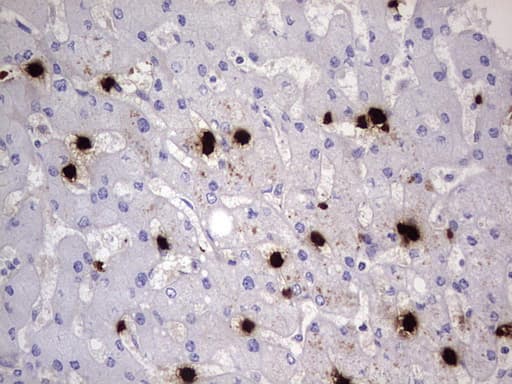 Monoclonal Mouse anti-Human S100A9 / MRP14 Antibody (clone OTI10D5, IHC, WB)