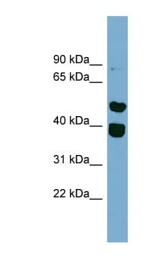 Polyclonal Rabbit anti-Human TRIM49 Antibody (aa359-408, WB)
