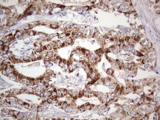 Monoclonal Mouse anti-Human ABAT Antibody (clone UMAB179, aa29-323, IHC, IF, WB)