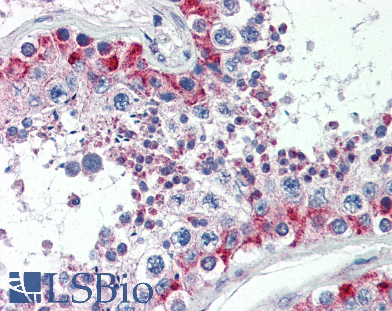 MAS1 / MAS Antibody (aa187-236)