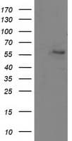 ATP6V1B1 Antibody (clone OTI2D2)
