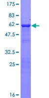 Human CBR3 Protein (Recombinant GST)