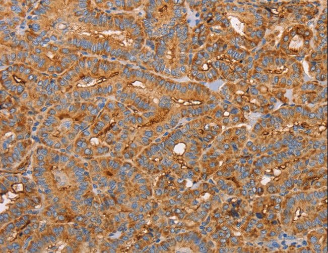 Polyclonal Rabbit anti-Human CD59 Antibody (IHC, WB)
