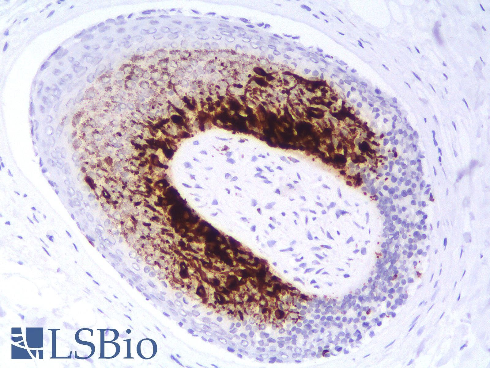 PathPlus™ MLANA / Melan-A Antibody (clone MLANA/1761R)