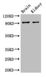 SLC9A1 / NHE1 Antibody