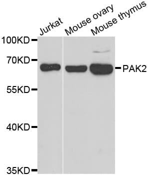 Polyclonal Rabbit anti-Human PAK2 Antibody (IHC, IF, WB)
