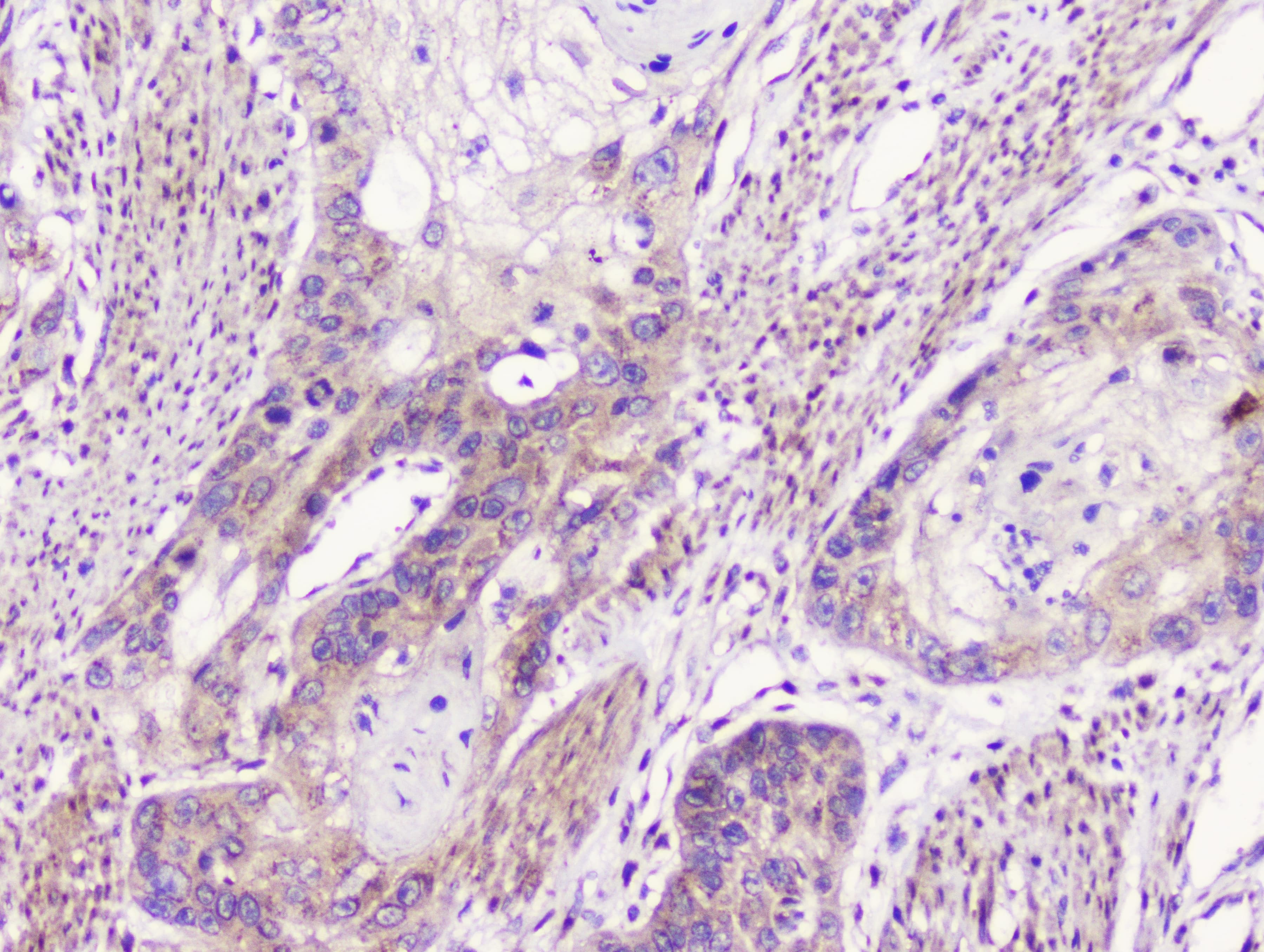 Polyclonal Rabbit anti-Human GOLGA2 / GM130 Antibody (IHC, WB)