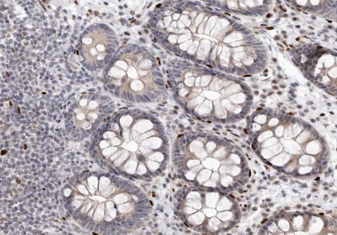 ABL1 / c-ABL Antibody (phospho-Tyr393,pTyr412)