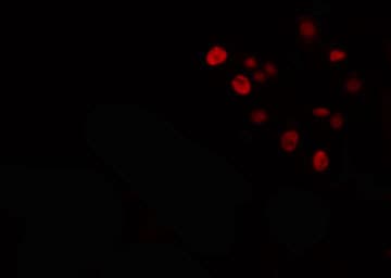Polyclonal Rabbit anti-Human EKLF / KLF1 Antibody (IF, WB)