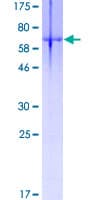 Human DMRT1 Protein (Recombinant GST)