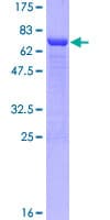 Human NCK1 / NCK Protein (Recombinant GST)
