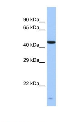 ZNF701 Antibody (aa251-300)