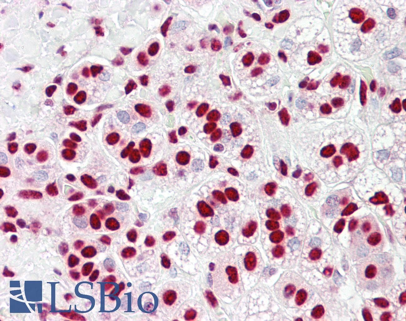 PathPlus™ HNRNPK / hnRNP K Antibody (aa200-250)