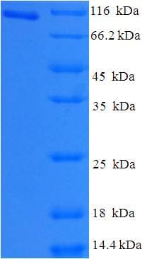 Human HJURP Protein (Recombinant His-SUMO)