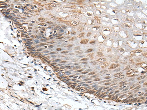 Polyclonal Rabbit anti-Human CHRNA5 Antibody (IHC)