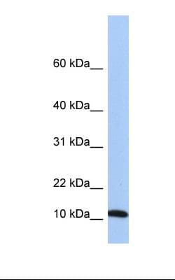 FAU / Fub1 Antibody (C-Terminus)