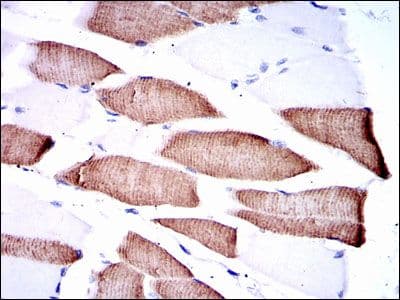 Monoclonal Mouse anti-Human MAP2K7 / MEK7 Antibody (clone 400000, IHC, IF, WB)