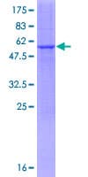 Human RDH13 Protein (Recombinant GST)