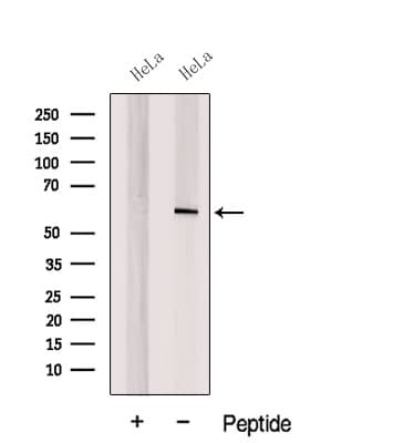 CORO1C Antibody