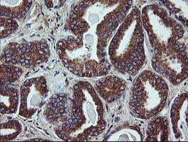 UBE2J1 Antibody (clone OTI3D1)
