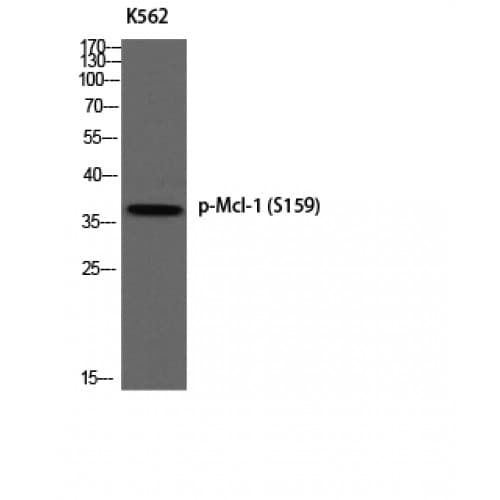 Polyclonal Rabbit anti-Human MCL1 / MCL 1 Antibody (100-180 aa, IF, WB)